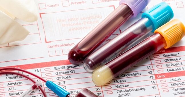Bloedonderzoek voor humaan papillomavirus