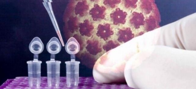 HPV-diagnostiek met behulp van de digene-test