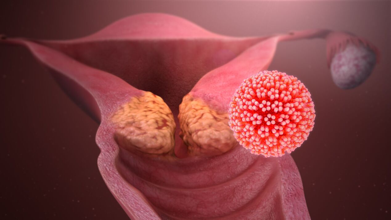 humaan papillomavirus in het lichaam